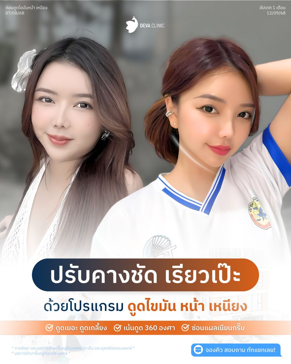 ดีว่ารีวิวหน้าเหนียง