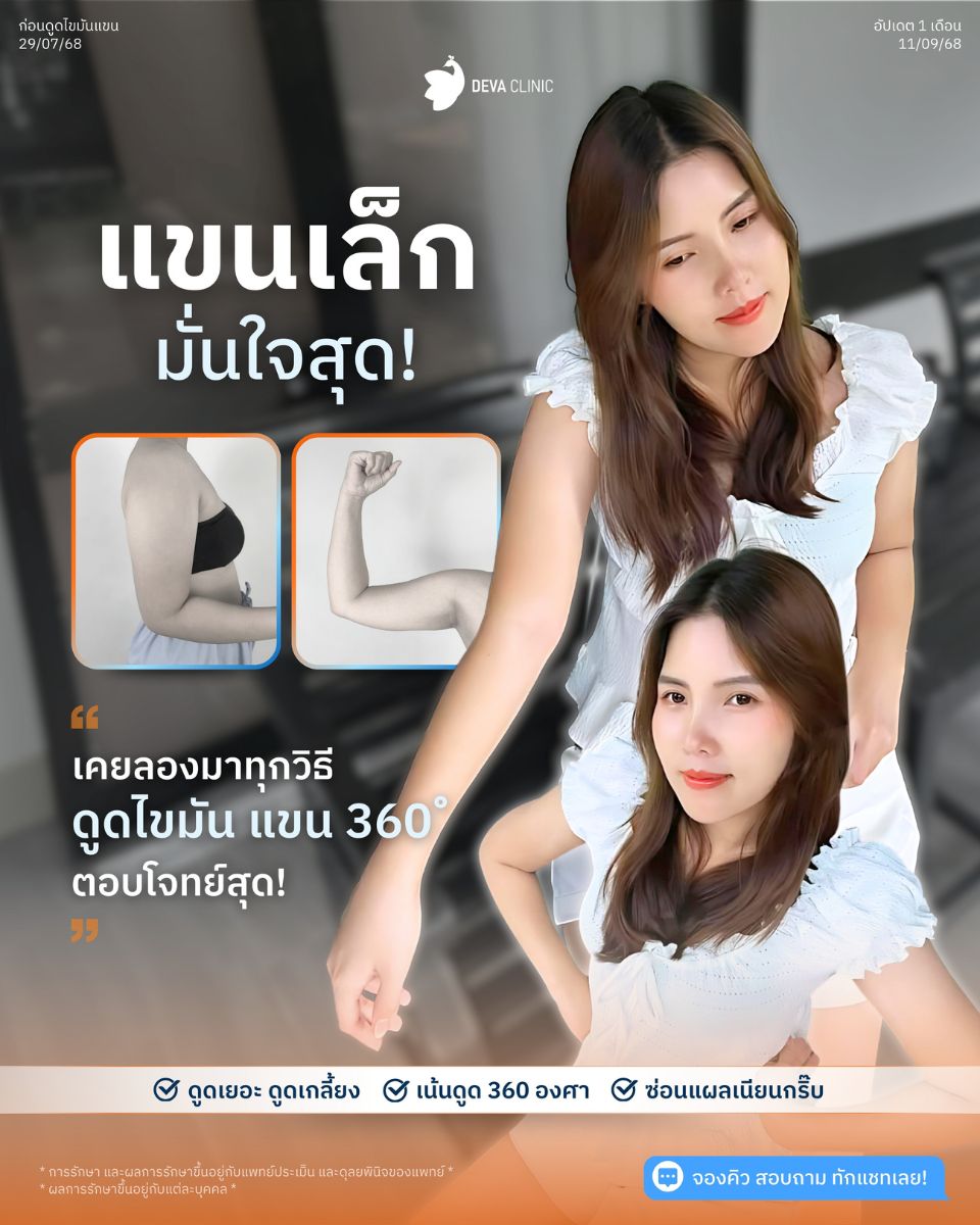 ดีว่ารีวิวแขน