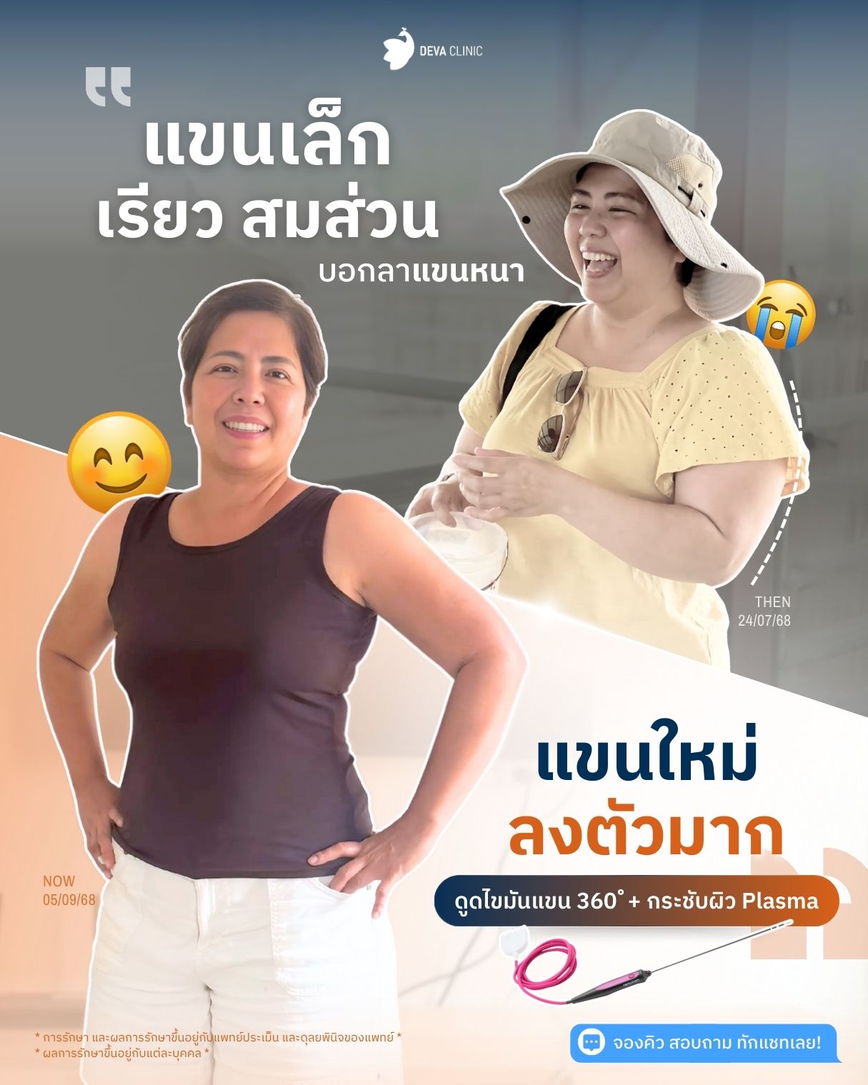 ดีว่ารีวิวเจพลาสม่า