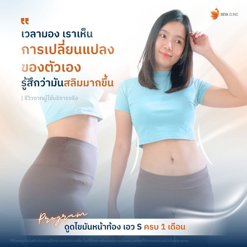 รีวิวความประทับใจ ดูดไขมันหน้าท้อง 3