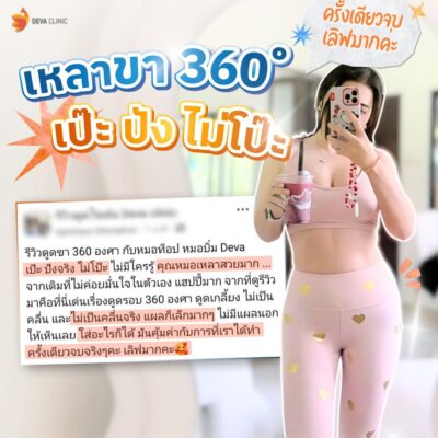 รวมรีวิวความประทับใจดูดไขมันต้นขา 7