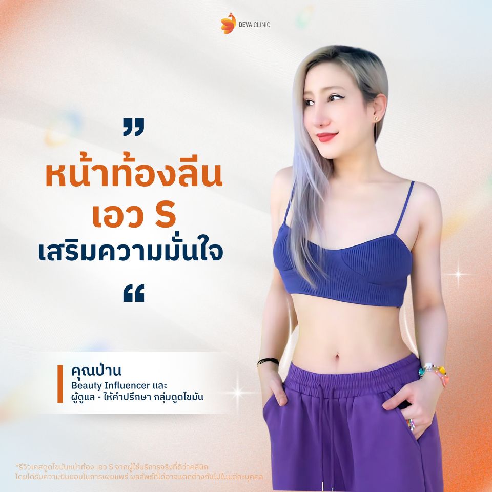 รีวิวความประทับใจ ดูดไขมันหน้าท้อง 1