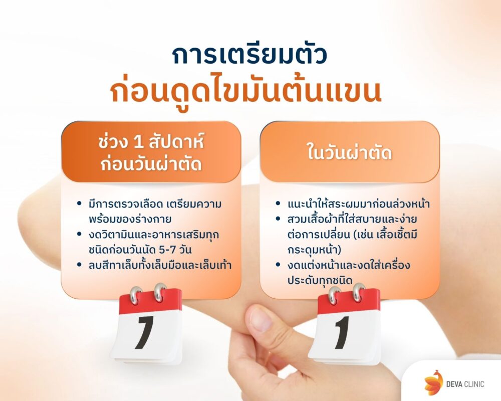 การเตรียมตัวก่อนดูดไขมันต้นแขน