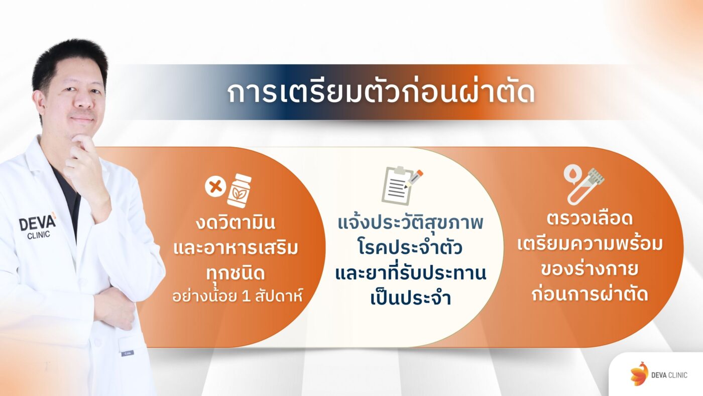 การเตรียมตัวก่อนดูดไขมันเหนียง
