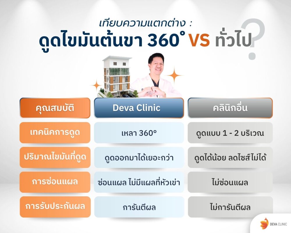 ตารางเปรียบเทียบดูดขา 360 องศา กับ ที่อื่น