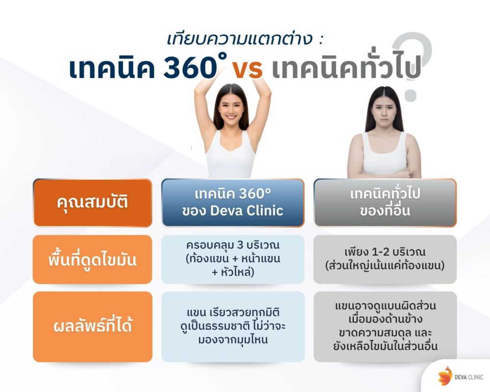 ตารางเปรียบเทียบแขน 360 องศา กับ ทั่วไป