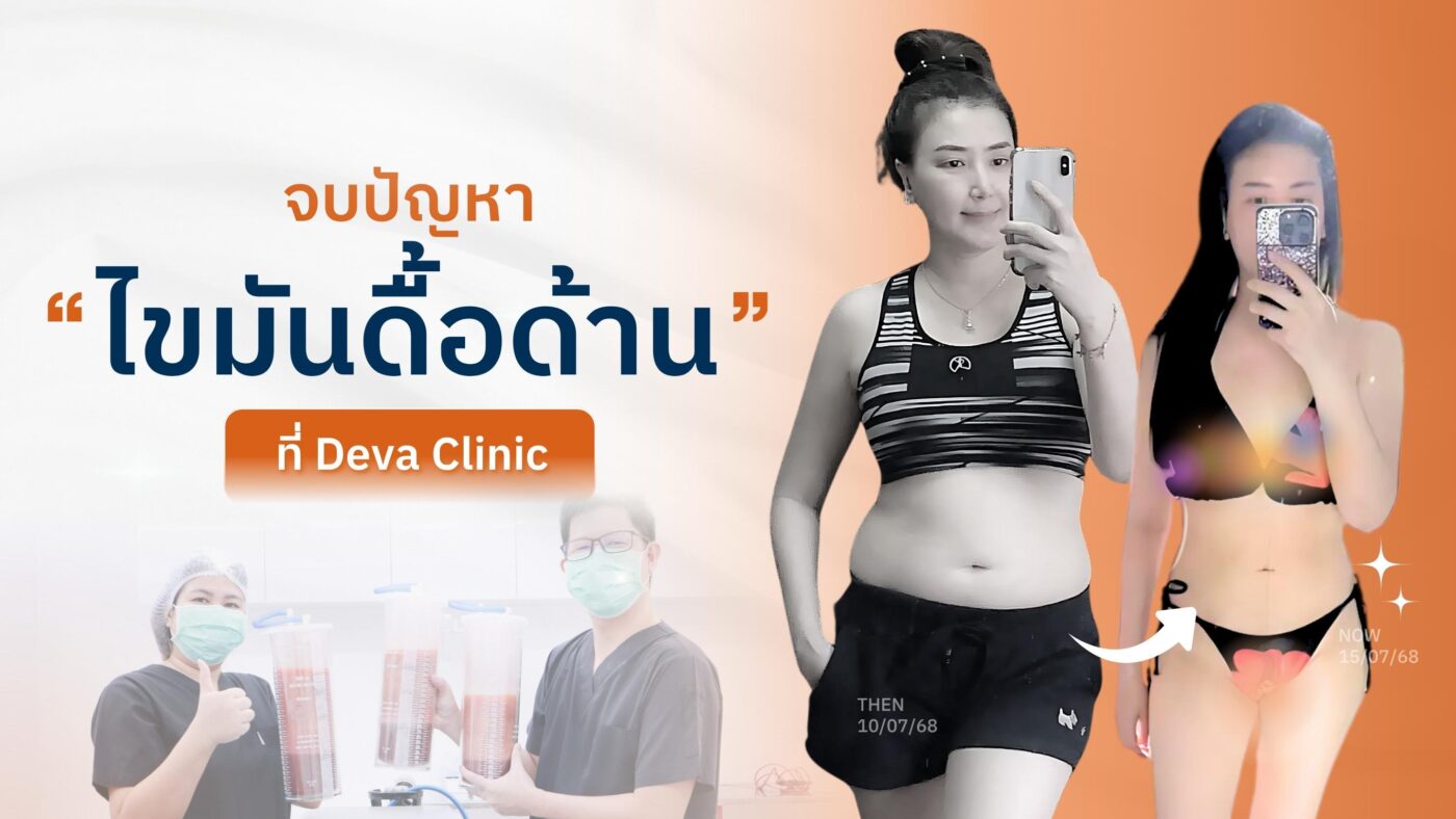 ดูดไขมัน deva clinic
