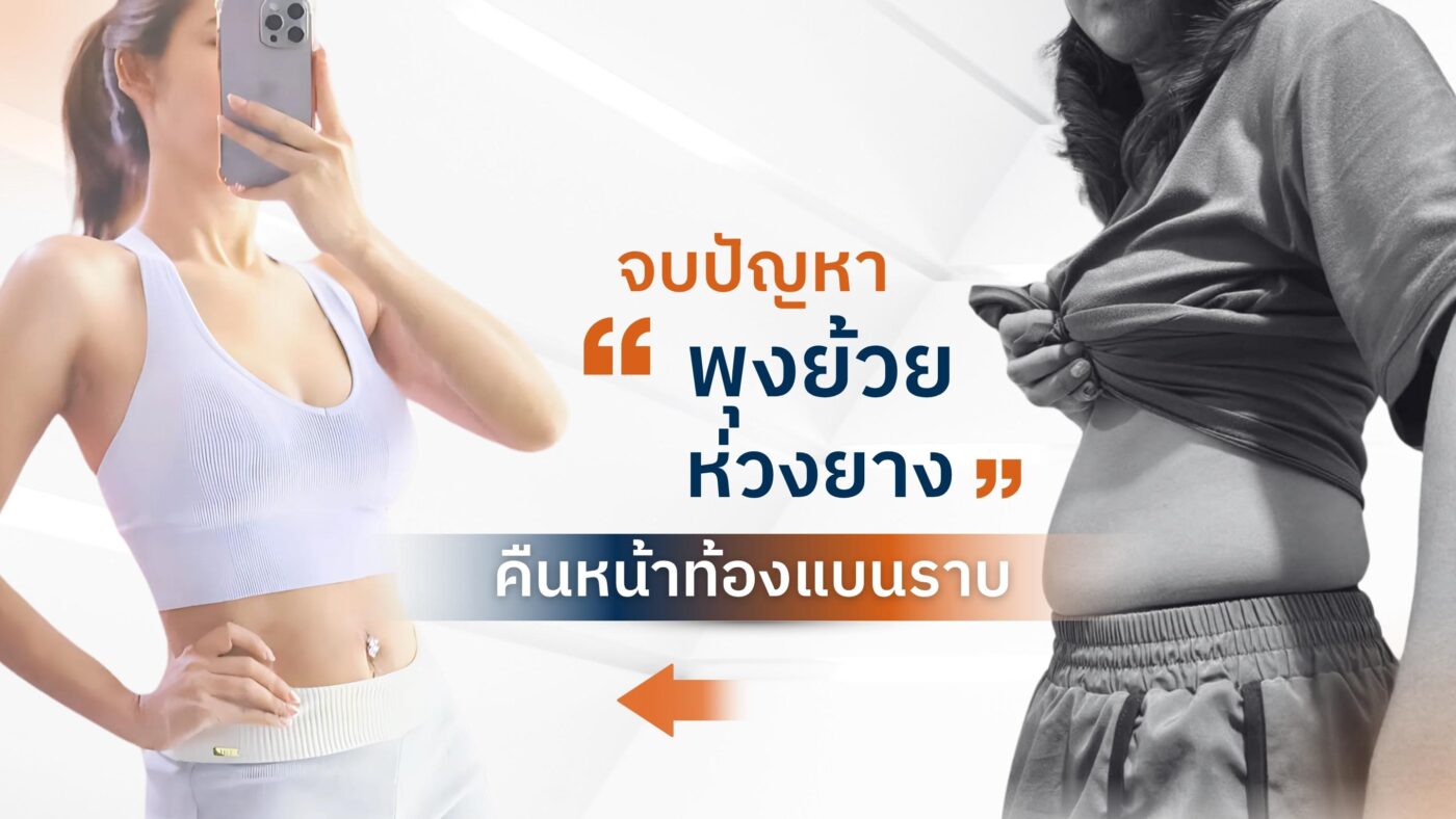 ดูดไขมันหน้าท้อง