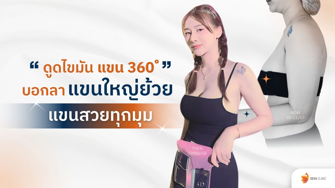 ดูดไขมันต้นแขน