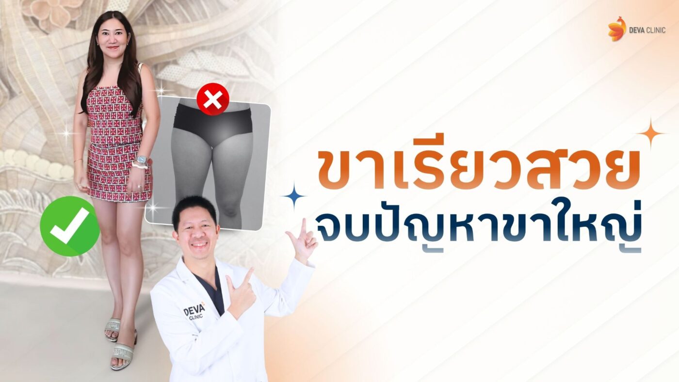 ดูดไขมันต้นขา deva clinic