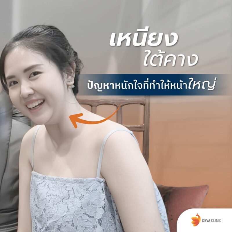 ปัญหาเหนียง ใต้คาง