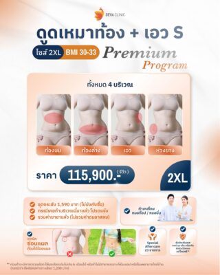 ราคาดูดไขมันหน้าท้อง 2xl