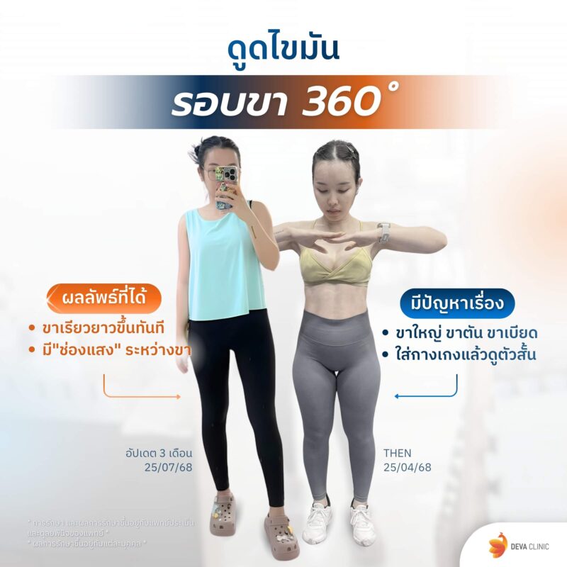 ดูดขา 360 องศา คุณมะปราง